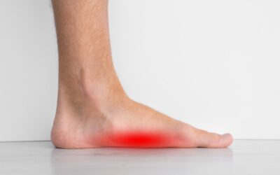 The Dangers of Flat Feet