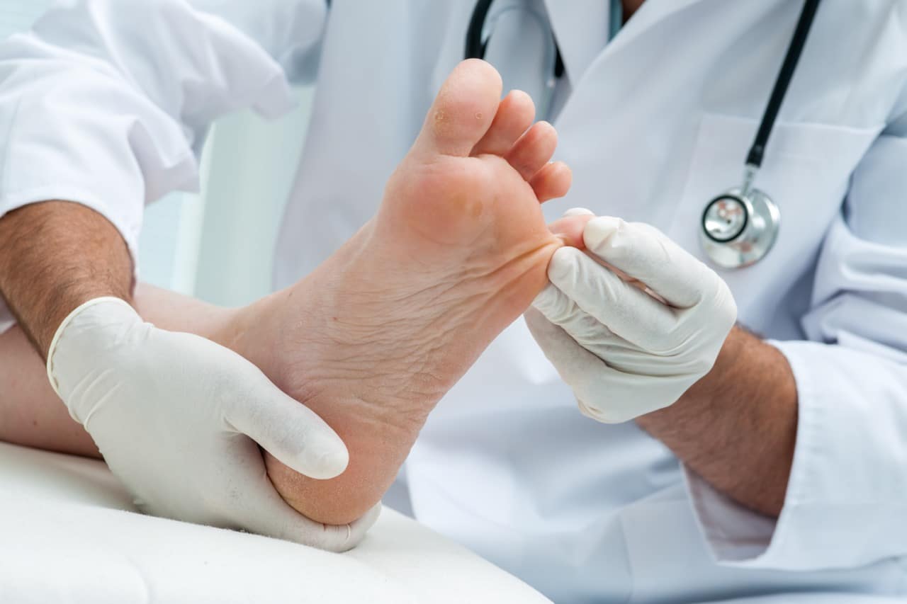 Doctor inspecting foot for Fungal nails